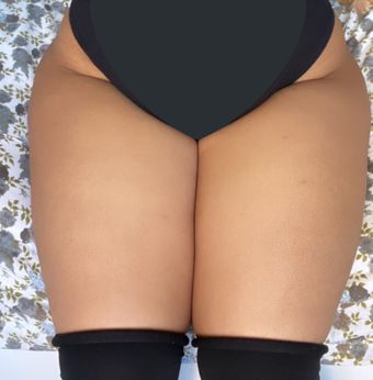 Fwoingus
