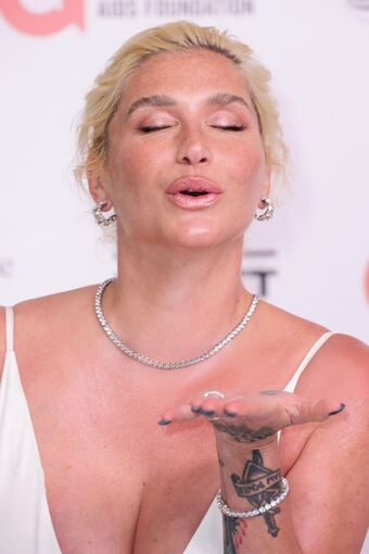 Kesha