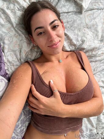lysssavage