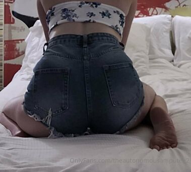 theautonomousamputee2