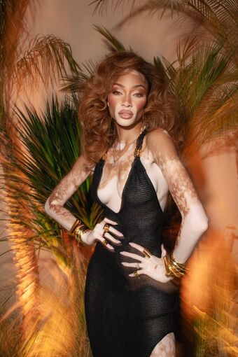 Winnie Harlow Foto Desnuda Filtrada OnlyFans 292