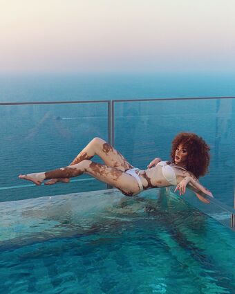 Winnie Harlow Foto Desnuda Filtrada OnlyFans 294