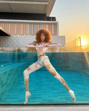 Winnie Harlow Foto Desnuda Filtrada OnlyFans 295