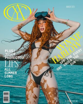 Winnie Harlow Foto Desnuda Filtrada OnlyFans 297