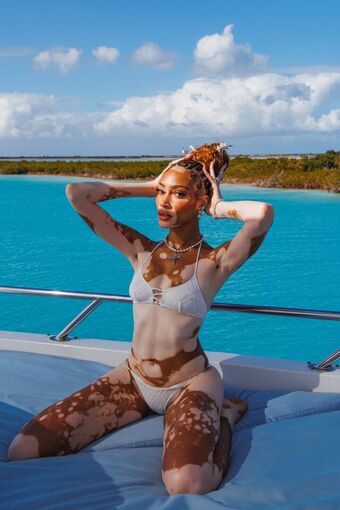 Winnie Harlow Foto Desnuda Filtrada OnlyFans 300